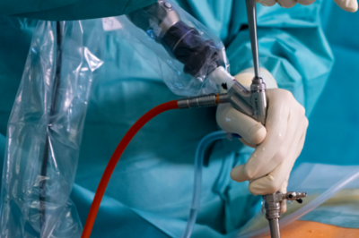 Endoskopische Bandscheibenoperation